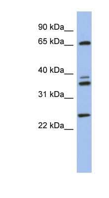 Western Blot: ATP6V1A Antibody [NBP1-55212]