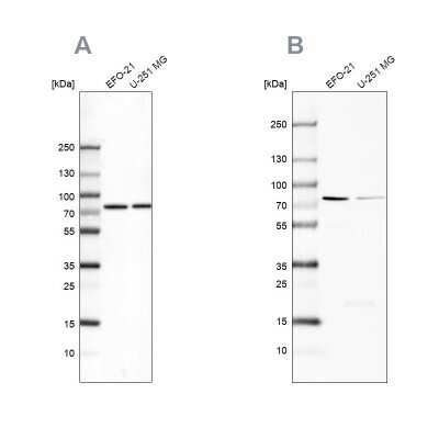 Western Blot: ATP6V1A Antibody [NBP2-55148]