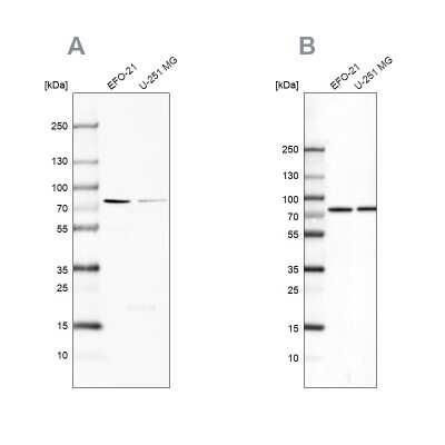 Western Blot: ATP6V1A Antibody [NBP2-55164]