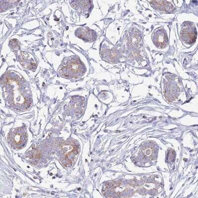 Immunohistochemistry-Paraffin: ATP6V1B1 Antibody [NBP2-33962]