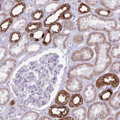 Immunohistochemistry-Paraffin: ATP6V1B1 Antibody [NBP2-33962]