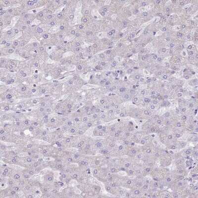 Immunohistochemistry-Paraffin: ATP6V1B1 Antibody [NBP2-33962]