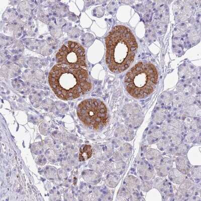 Immunohistochemistry-Paraffin: ATP6V1B1 Antibody [NBP2-33962]
