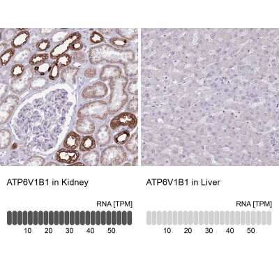 Immunohistochemistry-Paraffin: ATP6V1B1 Antibody [NBP2-33962]