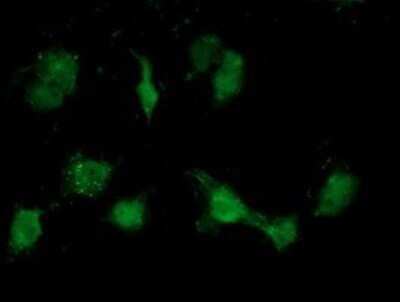 Immunocytochemistry/ Immunofluorescence: ATP6V1B1 Antibody (OTI1H6) - Azide and BSA Free [NBP2-70237]