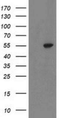 Western Blot: ATP6V1B1 Antibody (OTI1H6)Azide and BSA Free [NBP2-70237]