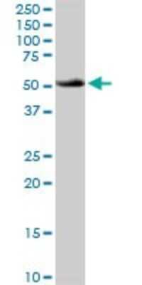 Western Blot: ATP6V1B1 Antibody [H00000525-D01P]