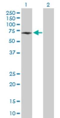 Western Blot: ATP6V1B1 Antibody [H00000525-D01P]
