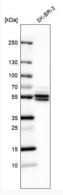 Western Blot: ATP6V1B1 Antibody [NBP2-33962]