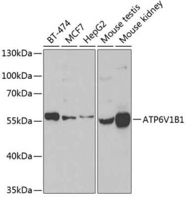 Western Blot: ATP6V1B1 AntibodyBSA Free [NBP2-92479]