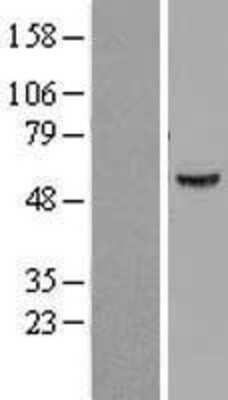 Western Blot: ATP6V1B1 Overexpression Lysate [NBL1-07838]