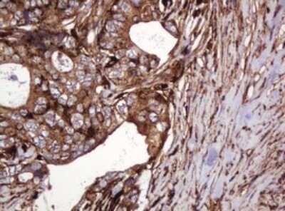 Immunohistochemistry: ATP6V1B2 Antibody (OTI1E11) [NBP2-45525]