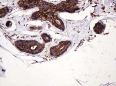 Immunohistochemistry: ATP6V1B2 Antibody (OTI1E11) [NBP2-45525]