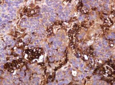 Immunohistochemistry: ATP6V1B2 Antibody (OTI1E11) [NBP2-45525]