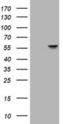 Western Blot: ATP6V1B2 Antibody (OTI1E11) [NBP2-45525]