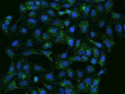 Immunocytochemistry/ Immunofluorescence: ATP6V1B2 Antibody [NBP2-97188]