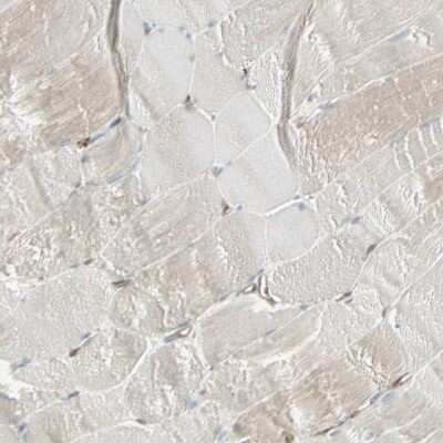 Immunohistochemistry-Paraffin: ATP6V1B2 Antibody [NBP1-88890]