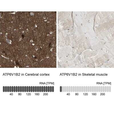 Immunohistochemistry-Paraffin: ATP6V1B2 Antibody [NBP1-88890]