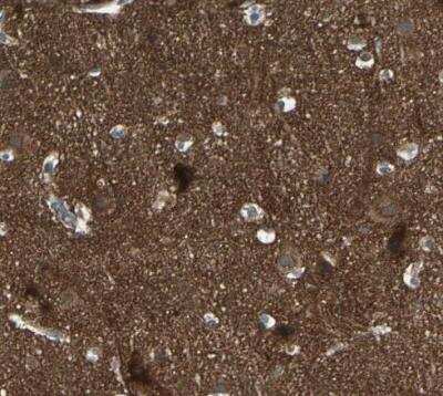 Immunohistochemistry-Paraffin: ATP6V1B2 Antibody [NBP1-88890]
