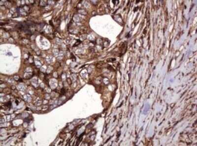 Immunohistochemistry: ATP6V1B2 Antibody (OTI1E11) - Azide and BSA Free [NBP2-70238]
