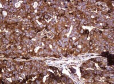 Immunohistochemistry: ATP6V1B2 Antibody (OTI1E11) - Azide and BSA Free [NBP2-70238]