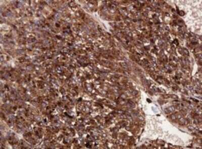 Immunohistochemistry: ATP6V1B2 Antibody (OTI1E11) - Azide and BSA Free [NBP2-70238]