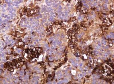 Immunohistochemistry: ATP6V1B2 Antibody (OTI1E11) - Azide and BSA Free [NBP2-70238]