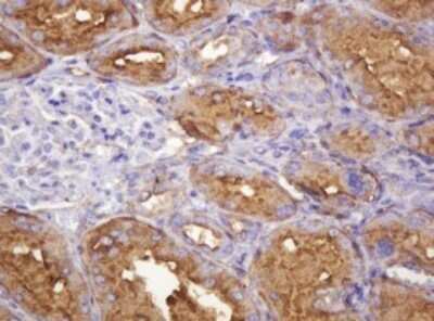 Immunohistochemistry: ATP6V1B2 Antibody (OTI1E11) - Azide and BSA Free [NBP2-70238]
