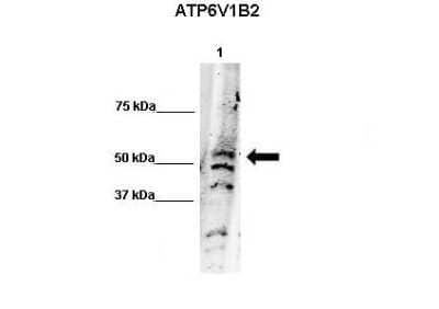 Western Blot: ATP6V1B2 Antibody [NBP1-54759]