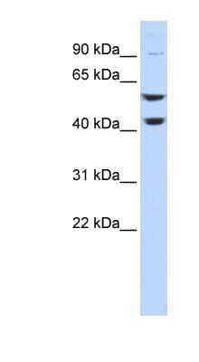 Western Blot: ATP6V1B2 Antibody [NBP1-54858]