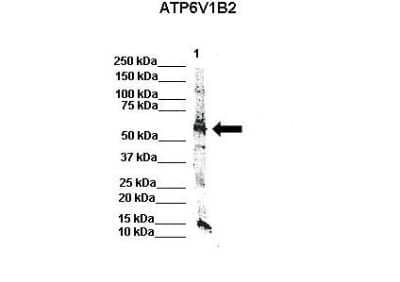 Western Blot: ATP6V1B2 Antibody [NBP1-54858]