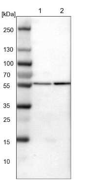 Western Blot: ATP6V1B2 Antibody [NBP1-88890]