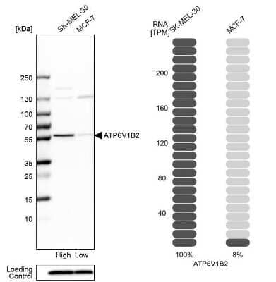 Western Blot: ATP6V1B2 Antibody [NBP1-88890]