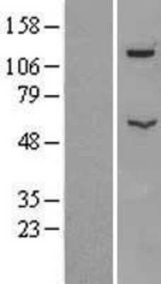 Western Blot: ATP6V1B2 Overexpression Lysate [NBL1-07839]