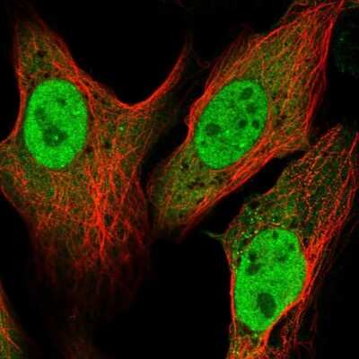 Immunocytochemistry/ Immunofluorescence: ATP6V1C1 Antibody [NBP2-58586]