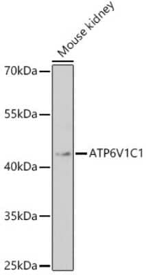 Western Blot: ATP6V1C1 AntibodyAzide and BSA Free [NBP2-92401]