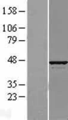 Western Blot: ATP6V1C1 Overexpression Lysate [NBL1-07840]