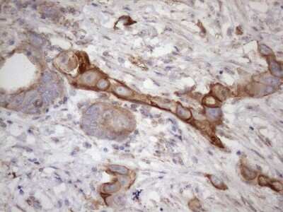 Immunohistochemistry: ATP6V1C2 Antibody (OTI8H4) [NBP2-46556]
