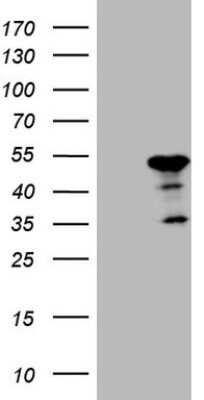 Western Blot: ATP6V1C2 Antibody (OTI8H4) [NBP2-46556]