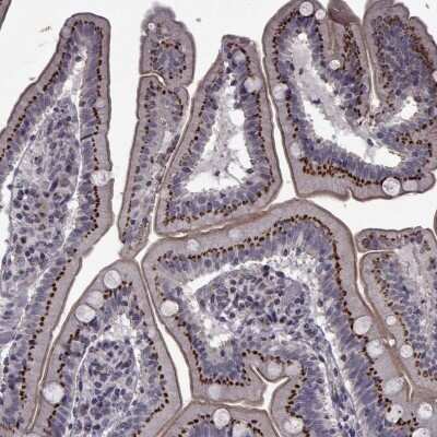 Immunocytochemistry/ Immunofluorescence: ATP6V1C2 Antibody [NBP2-68854]