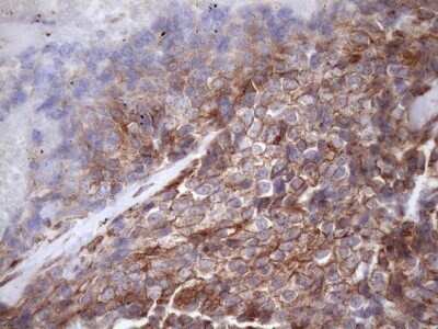 Immunohistochemistry: ATP6V1C2 Antibody (OTI8H4) - Azide and BSA Free [NBP2-72465]