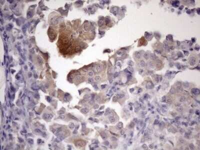 Immunohistochemistry: ATP6V1C2 Antibody (OTI8H4) - Azide and BSA Free [NBP2-72465]
