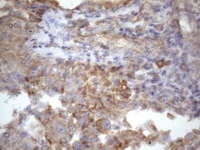 Immunohistochemistry: ATP6V1C2 Antibody (OTI8H4) - Azide and BSA Free [NBP2-72465]