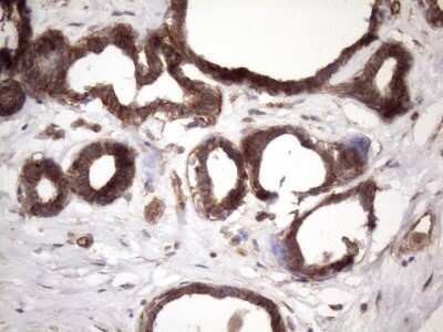 Immunohistochemistry: ATP6V1C2 Antibody (OTI8H4) - Azide and BSA Free [NBP2-72465]