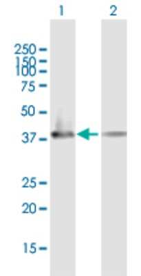 Western Blot: ATP6V1C2 Antibody [H00245973-B01P]