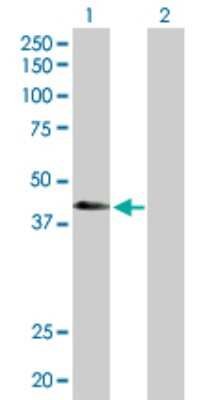 Western Blot: ATP6V1C2 Antibody [H00245973-D01P]