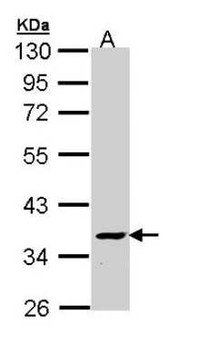 Western Blot: ATP6V1C2 Antibody [NBP1-33020]