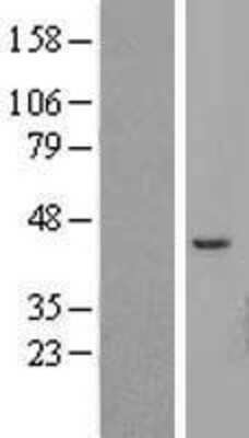 Western Blot: ATP6V1C2 Overexpression Lysate [NBL1-07841]