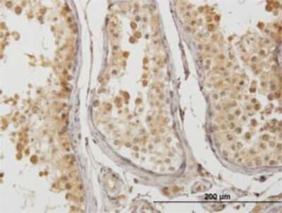 Immunohistochemistry-Paraffin: ATP6V1D Antibody (3G4) [H00051382-M01]