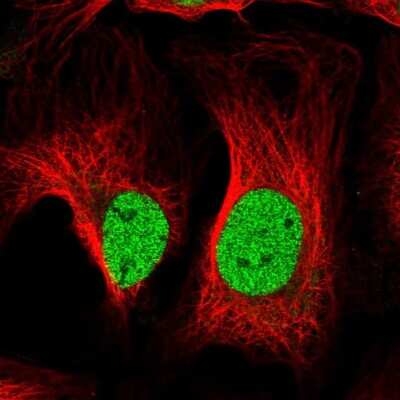 Immunocytochemistry/ Immunofluorescence: ATP6V1D Antibody [NBP2-49254]